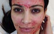 Kim Kardashian Bikin Syok Facial Wajah Pakai Darah
