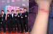 Tak Tahan EXO Dikritik, Fans Sayat Pergelangan Tangan