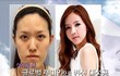 Sering Dicaci Berwajah Jelek, Gadis Ini Operasi Mirip Jessica SNSD