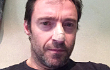 Hugh Jackman Pamer Foto Usai Jalani Operasi Kanker Kulit