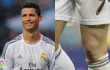 Cristiano Ronaldo Dicemooh Fans Walau Kaki Berdarah dan Cetak Gol