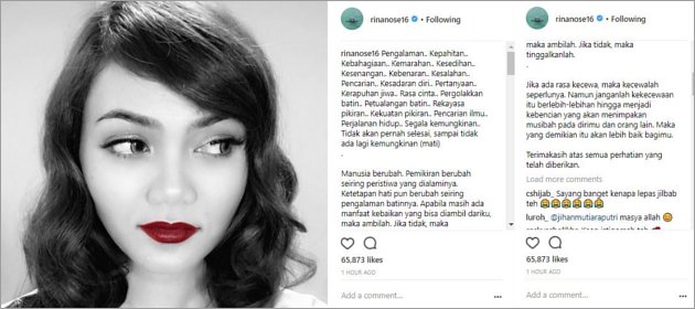 Rina Nose Unggah Foto Lepas Hijab