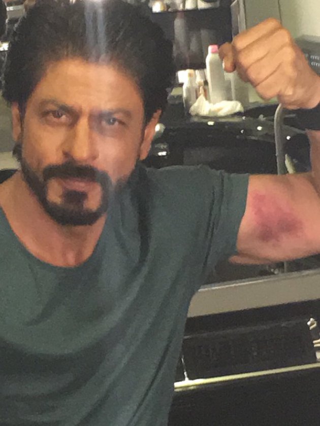 Pamer Foto Luka Memar di Lokasi Syuting 'Dilwale', SRK ...