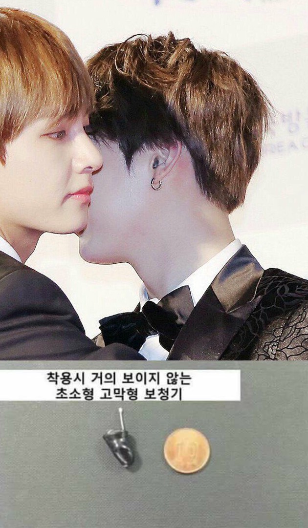 Terbentur Pintu, Kini Suga BTS Pakai Alat Bantu Dengar?