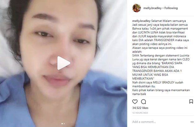 Heboh Video Operasi Lucinta Luna Tanpa Sensor, Lucunya Bayi Zaskia Adya
